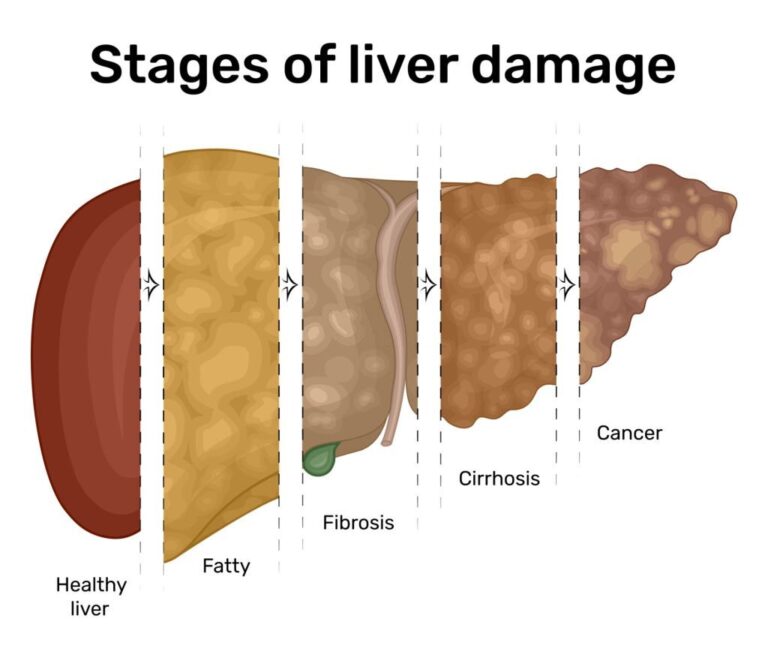 Organic India’s herbal formula supports liver and kidney health naturally. Ideal for detox, energy, and overall wellness. Want to feel lighter and healthier? Our herbal remedy is just a message away. Tap below to order or ask questions